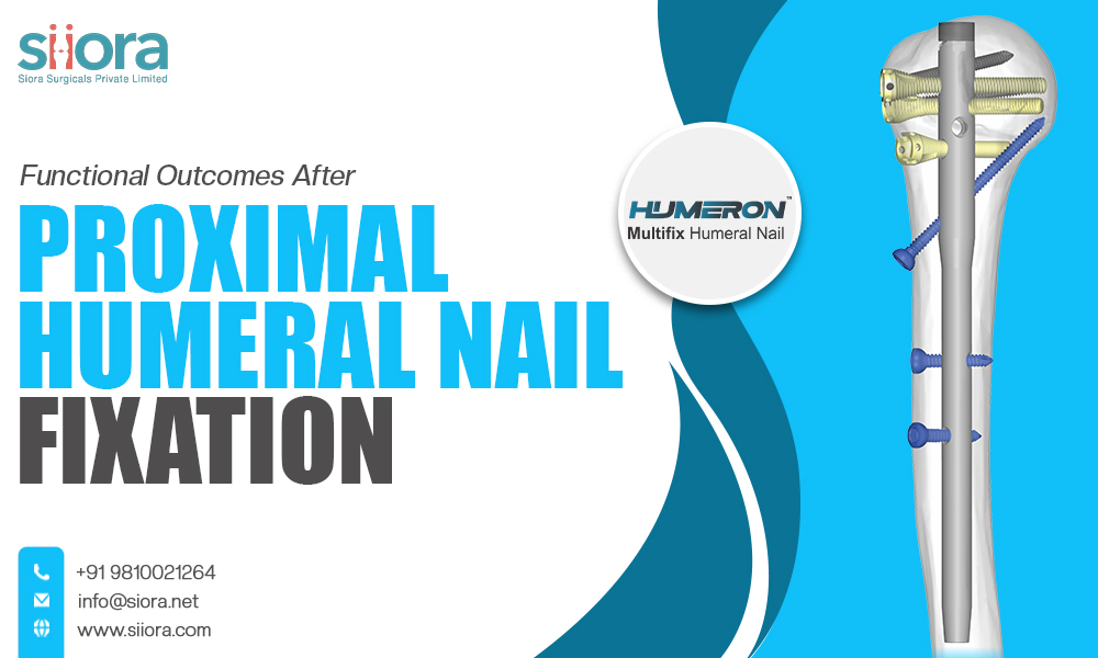 Proximal Humeral Nail Fixation