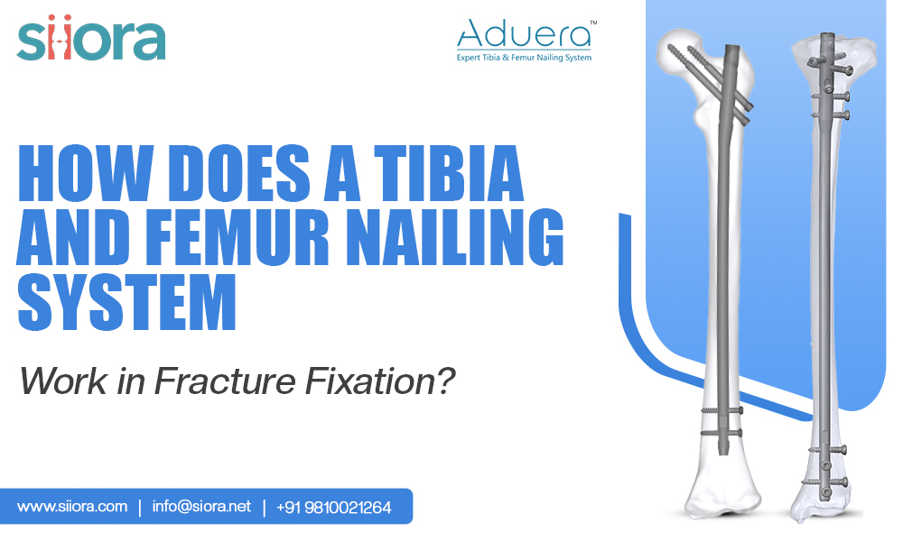 Tibia and Femur Nailing System